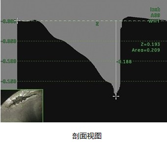 高清内窥镜Mentor Visual iQ HD剖面视图