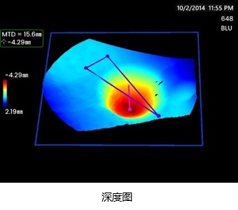 3DPM-深度图