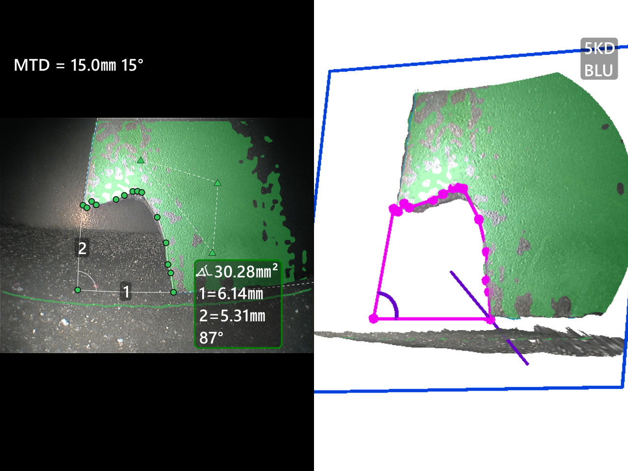 韦林Everest MViQ+工业视频内窥镜精准测量效果图 韦林Everest MViQ+工业视频内窥镜精准测量效果图